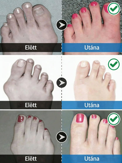 🔥Forró akció🔥Uniszex láthatatlan korrekciós ötujjú zokni