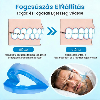 😴 Flanora horkolásgátló eszköz: Csökkentse a horkolást már az első éjszakától! ✨
